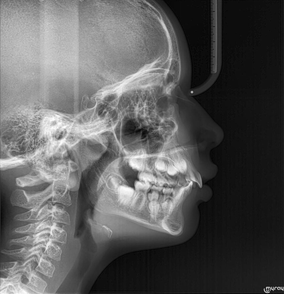 Première consultation