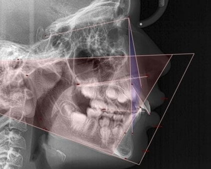 Première consultation